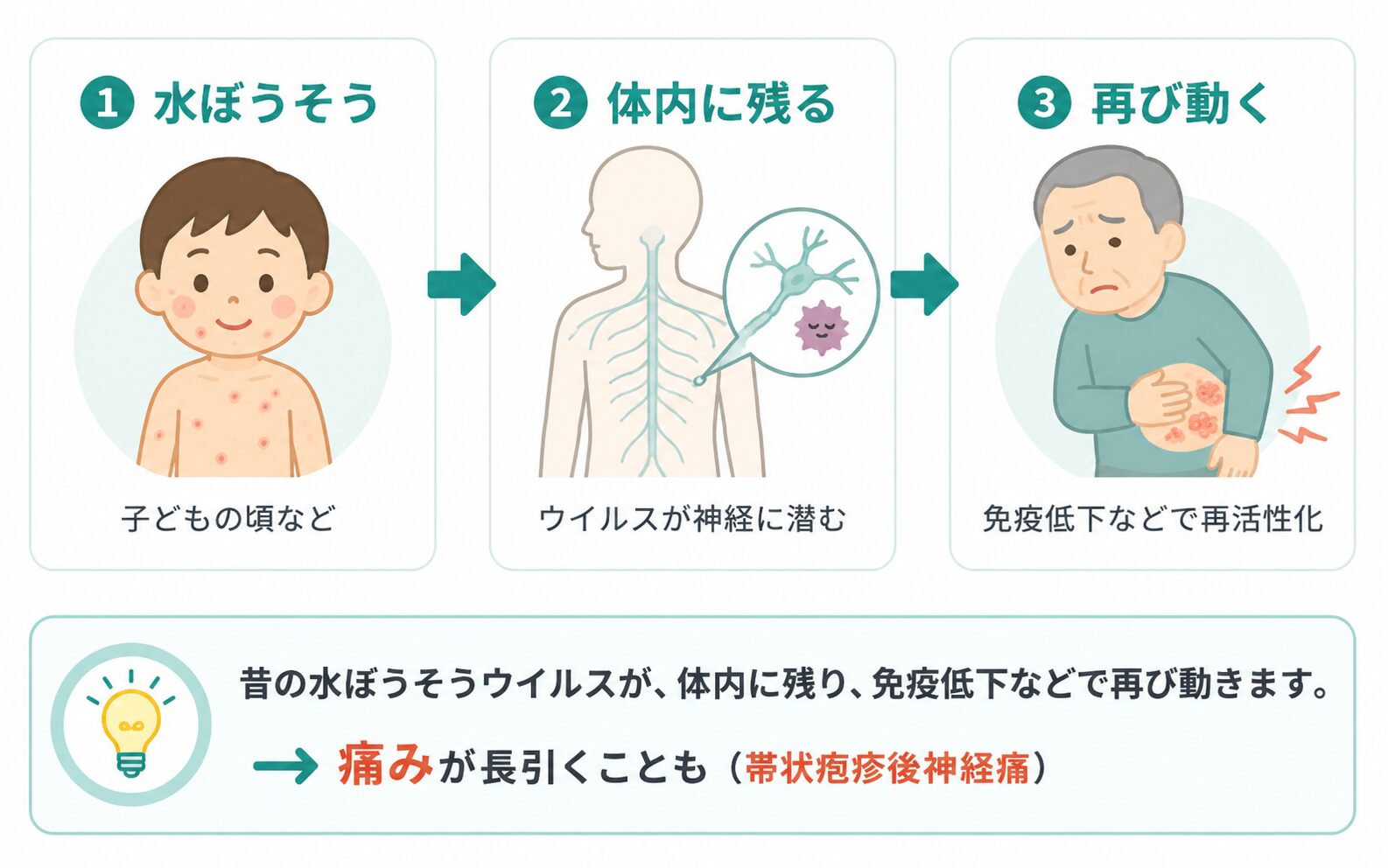 水ぼうそうウイルスが体内に残り、免疫低下などで再び動いて帯状疱疹になる流れを示した図解